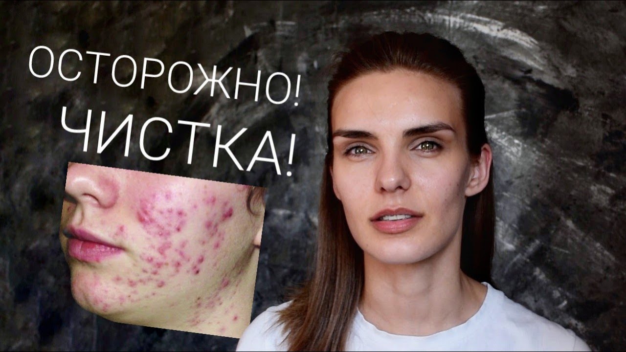 ТРИ причины не делать ЧИСТКУ ЛИЦА!  ВСЯ ПРАВДА О МЕХАНИЧЕСКОЙ ЧИСТКЕ! Косметологи врут