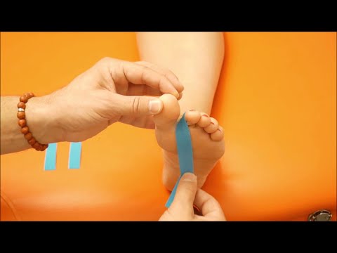 Podo Taping Concept© - The claw toe