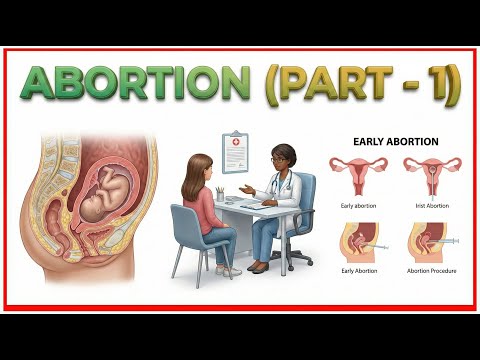 16. Abortion (Part - 1): Obstetrics and Gynecology Lecture
