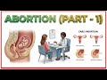 16 Abortion Part 1 Obstetrics And Gynecology Lecture