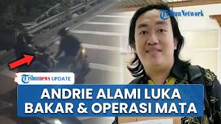 Kondisi Terkini Andrie Yunus Pasca Disiram Air Keras, Alami Luka Bakar hingga Jalani Operasi Mata