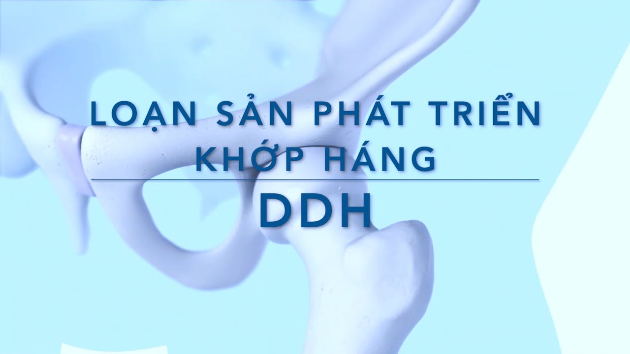 Bb70. Loạn sản phát triển khớp háng ở trẻ nhỏ