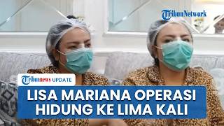 Peduli Penampilan dan Percantik Diri, Lisa Mariana Kembali Operasi Hidung Budgetnya Gak Main-main
