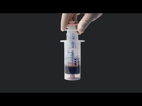 PRP-Erstellung mit dem ACP Max™ PRP-System