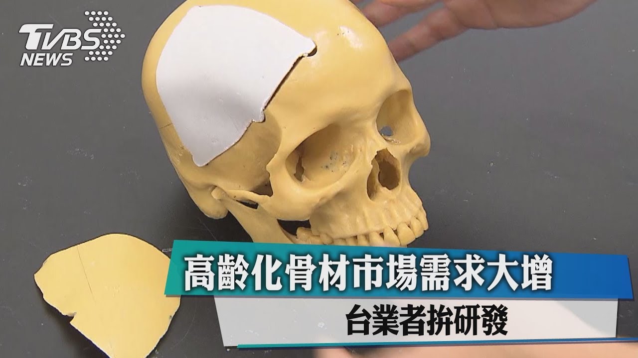 高齡化骨材市場需求大增 台業者拚研發