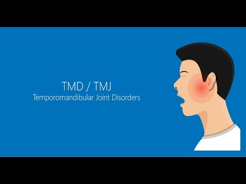 Facial Arthrocentesis