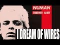 Gary Numan -I Dream of Wires
