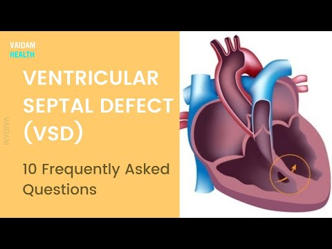 VSD - 10 Frequently Asked Questions