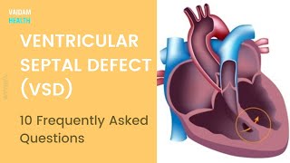 VSD - 10 Frequently Asked Questions