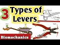 3 Types of levers/biomechanics / first class lever/second class lever/3rd class lever.
