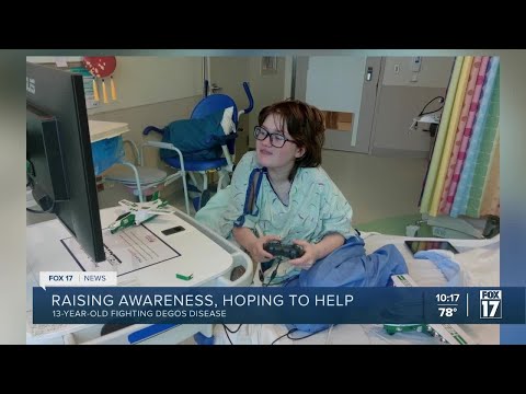 Muskegon teen diagnosed with rare Degos disease, family hosting bake sale for research, awareness