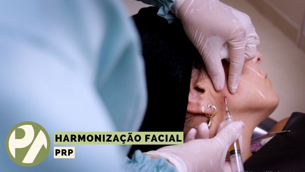 Harmonização Facial - PRP - Programa Pedro Alcântara - 17.03.2022