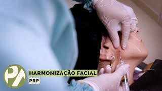 Harmonização Facial - PRP - Programa Pedro Alcântara - 17.03.2022