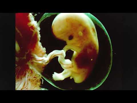 If