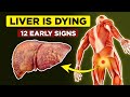 LIVER is DYING! 12 Weird Signs of Liver Damage | Healthify