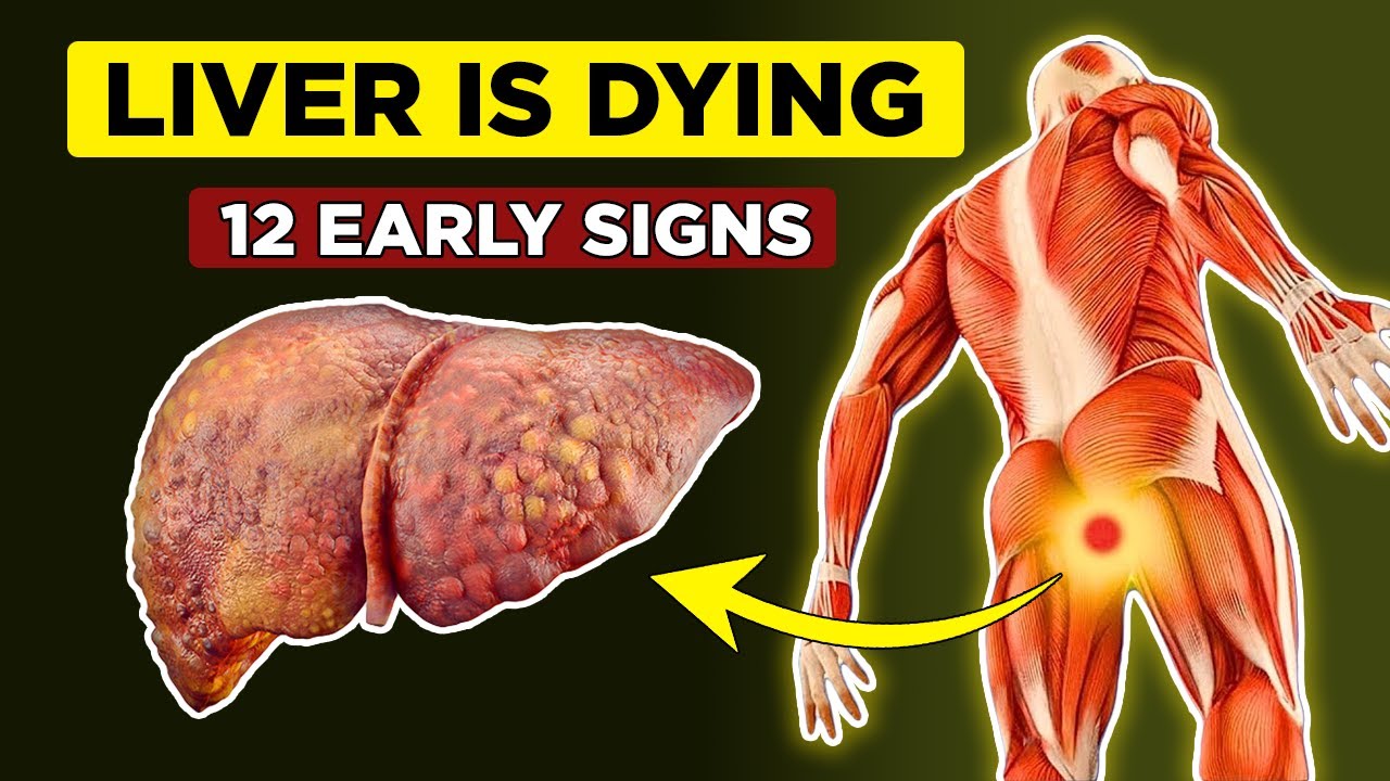 LIVER is DYING! 12 Weird Signs of Liver Damage | Healthify