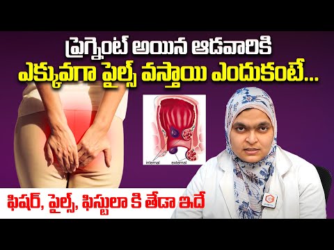 ప్రెగ్నెంట్ అయిన ఆడవారికి ఎక్కువ పైల్స్ వస్తాయి ఎందుకంటే: Why Piles Occur In Pregnancy | Fissures