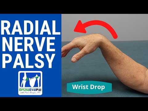 CMC Arthritis vs Dequervain s