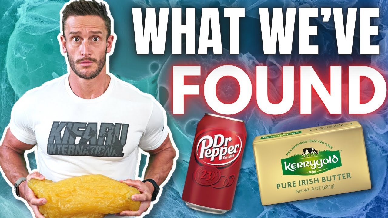 The #1 Cause of Visceral Fat and Fatty Liver is NOT Sugar (it’s THIS)