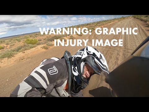 Motorbike Adventure: 3rd BROKEN LEG - Day 2, Chp. 1