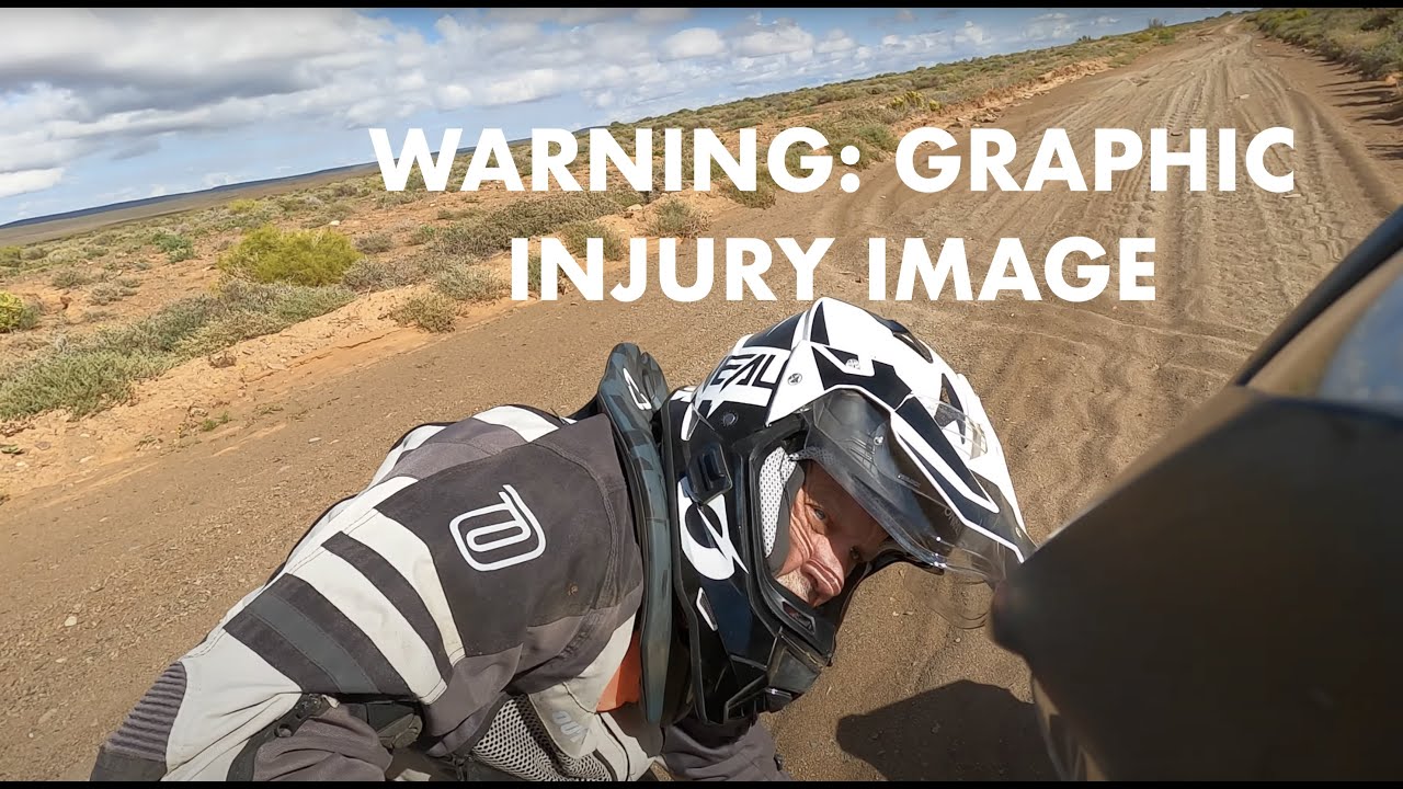 Motorbike Adventure: 3rd BROKEN LEG - Day 2, Chp. 1