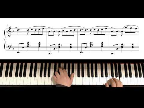 Motor Psico - Los Redondos | Piano Cover + Partitura Gratis / Free Sheet Music
