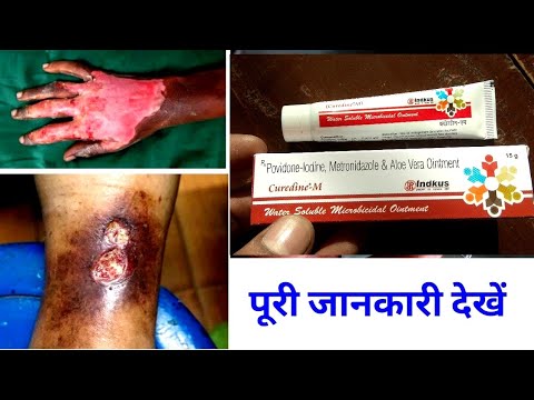 Povidone Iodine, Metronidazole & Aloe Vera Ointment