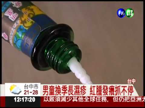 明星花露水治過敏? 手爛長水泡