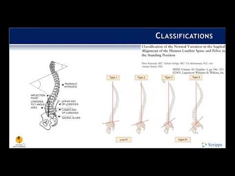 Classification: Adult Spinal Deformity