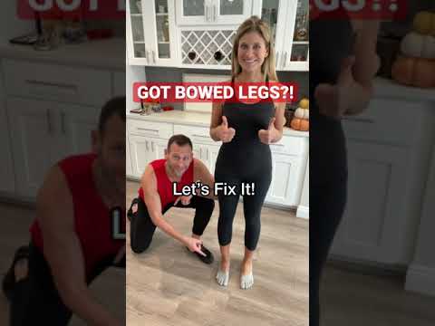 How To Fix Your Bowed Legs! #shorts #kneepain #exercisetips