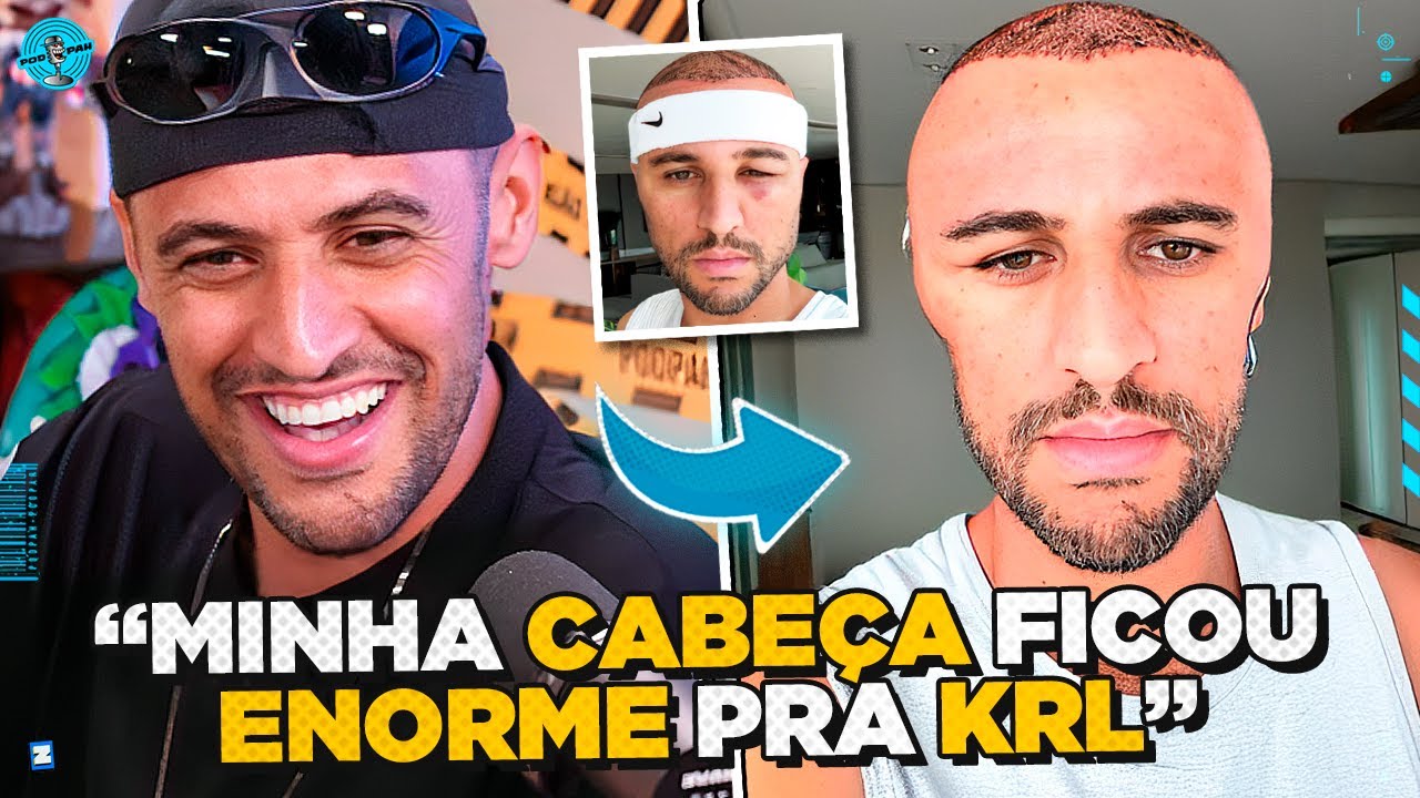 Deu ERRO no IMPLANTE CAPILAR do WESLEY ALEMÃO kkkkkk