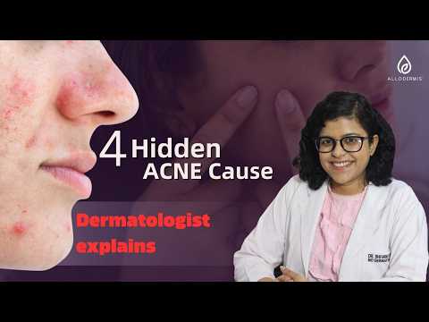 Allodermis featured video
