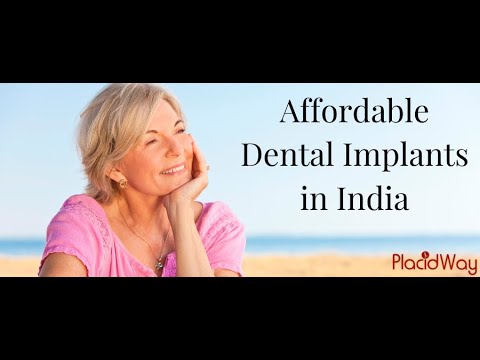 Safe and Affordable Options of Dental Implants in India