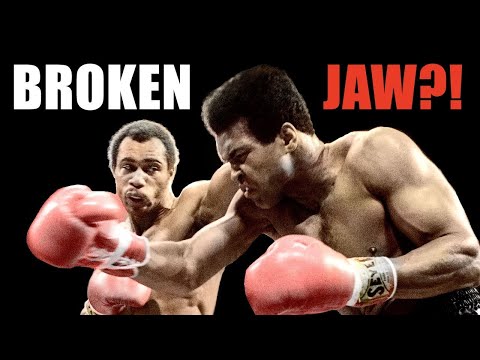 Ali's Toughest Fight Explained! - Muhammad Ali vs Ken Norton | Fight Breakdown