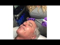 Dr Frank Barone MD Hydrafacial Part 1 Evolv Plastic Surgery