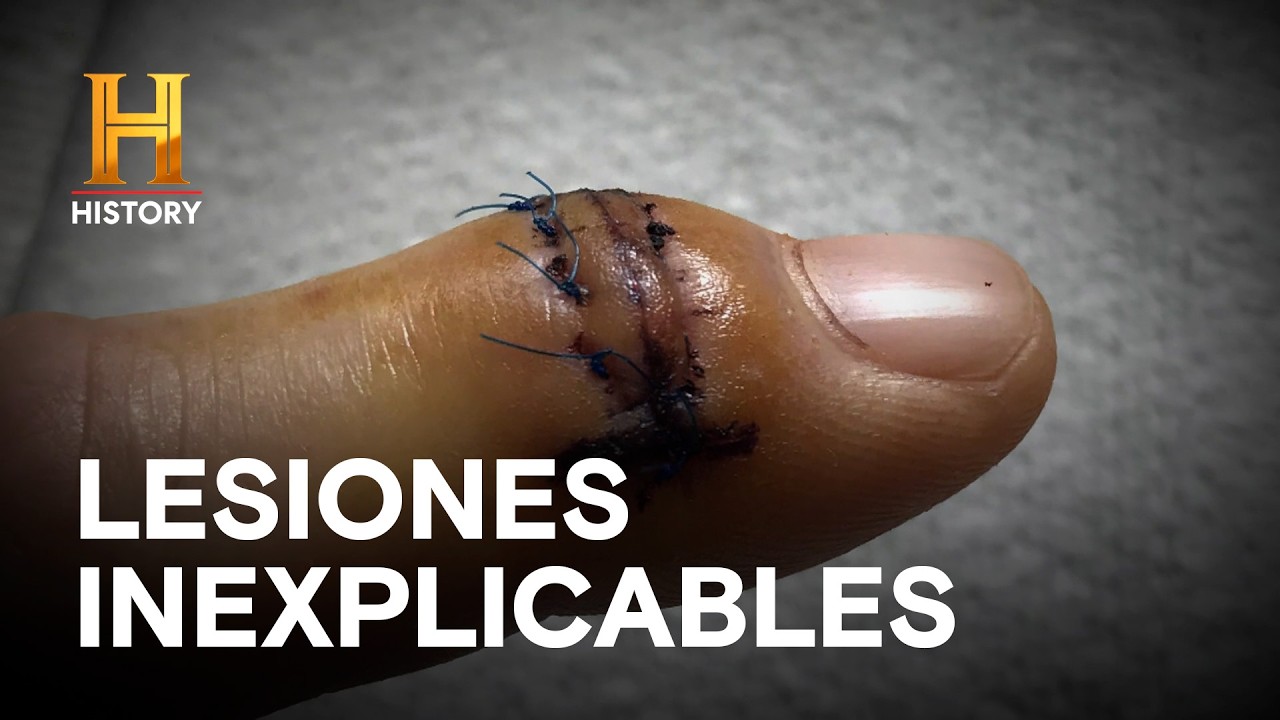 Heridas Sin Causa Aparente - EL SECRETO DE SKINWALKER