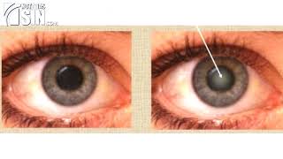 Expertos hacen recomendaciones para observar el eclipse solar de este lunes sin afectar la visión