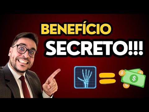 Auxílio Acidente: Como Conseguir Esse Benefício no INSS!