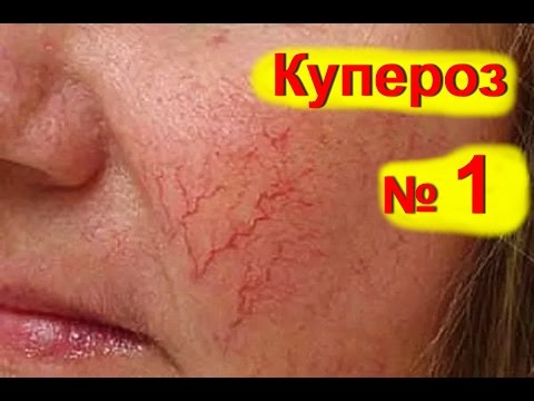 Действующий крем от веснушек Отбеливающие крема для лица до и после