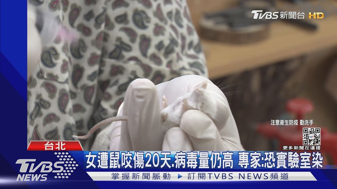 女遭鼠咬傷20天病毒量仍高 專家:恐實驗室染