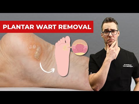 Best Wound Care Centers in Michigan Skin Diabetic Foot Ulcers