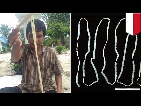 Ulasan Xenical kehilangan Photo berat badan Mengapa menurunkan berat badan di laut