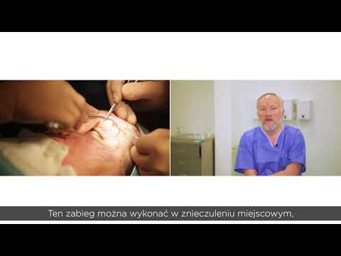 Ćwiczenia na wzmocnienie mięśni pleców dla kobiet w ciąży Funkcji mięśnia szkieletowego w korpusie