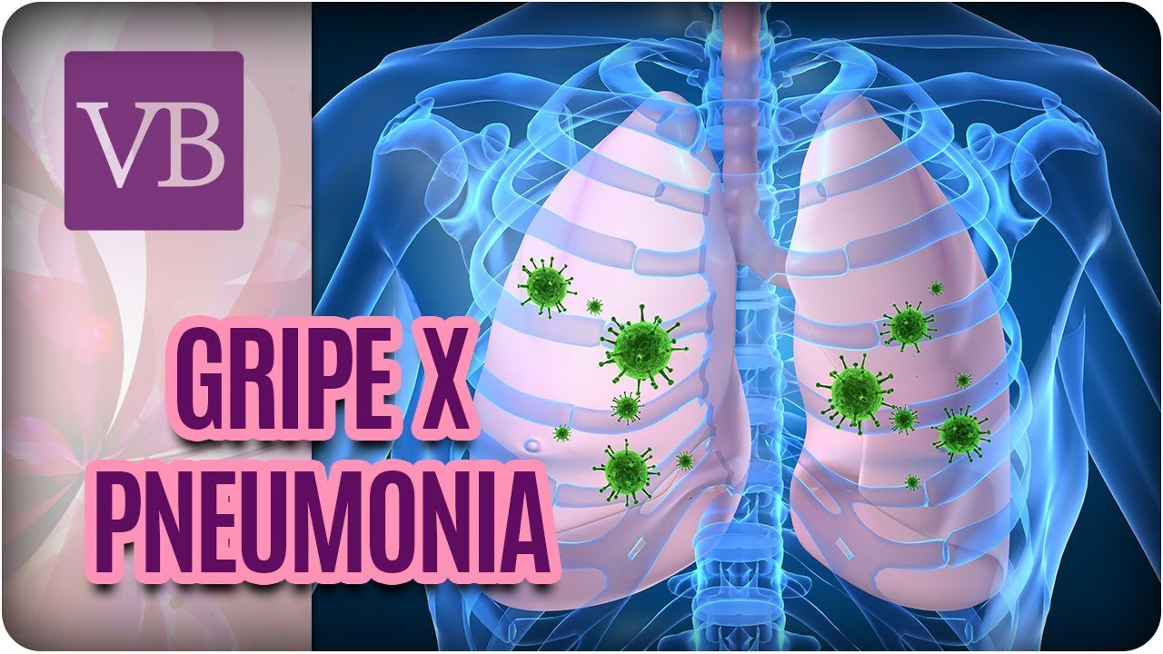 Gripe x Pneumonia: Como Diferenciar - Você Bonita (26/02/18)