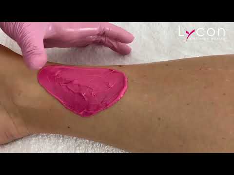 Pinkini Brazilian Hot (hard) Wax using Lycon waxing techniques for best results