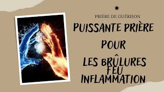 Puissante prière pour barrer le feu : brûlures/sensation de chaud/inflammation