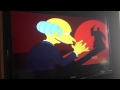 Burns Singing about being Hated 