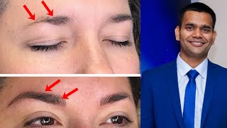 How To Grow Thicker Eyebrows Naturally and Faster | Dr. Vivek Joshi