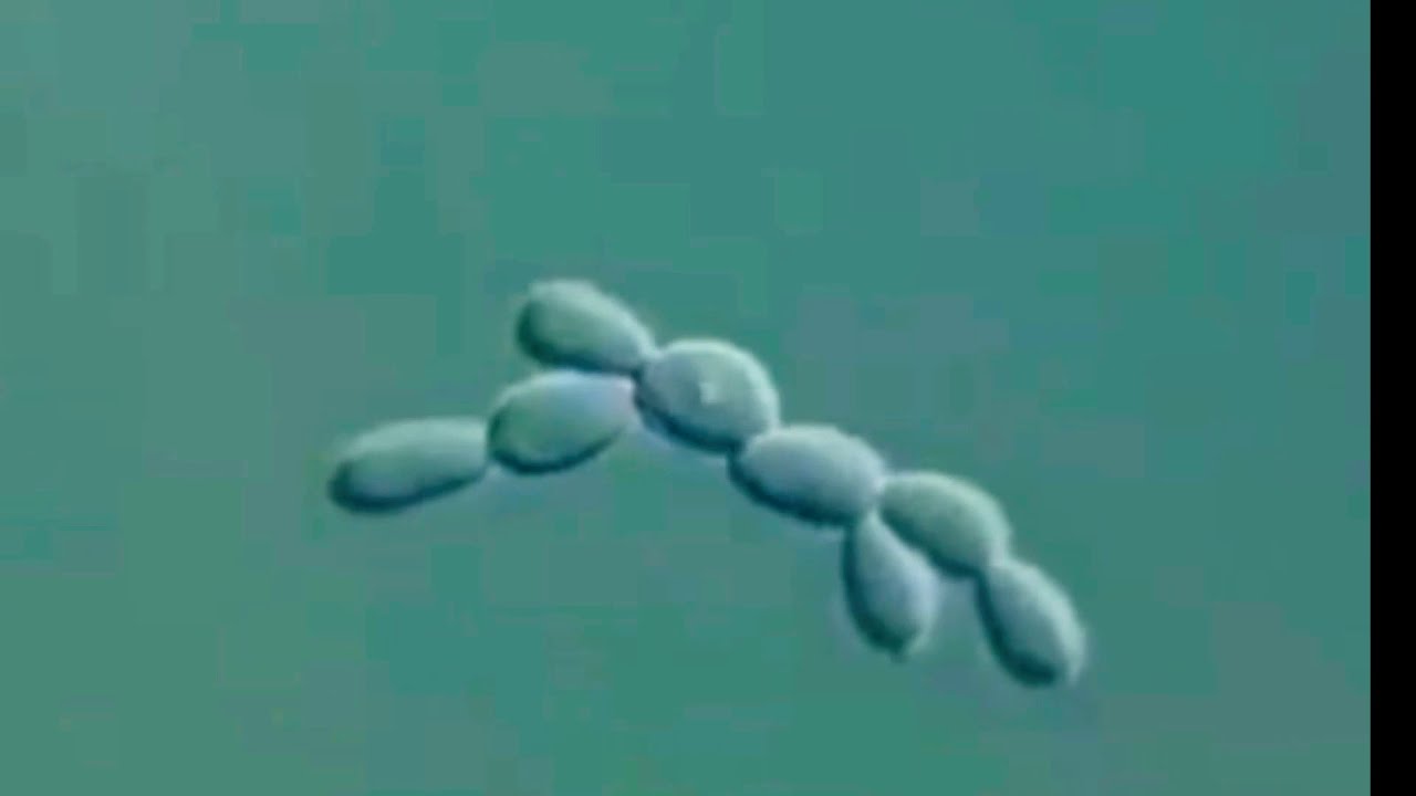 Budding of Yeast cells under microscope - #Microbiology