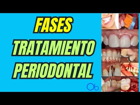 Fases del Tratamiento Periodontal